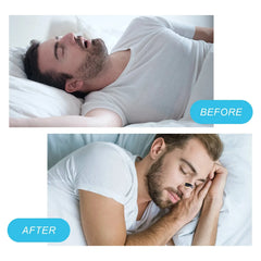 Magnetic Nasal Dilator Anti Snoring Nose Strips,Boost Oxygen Intake,Sleep Nasal Breathing Dilators Starter Kit
